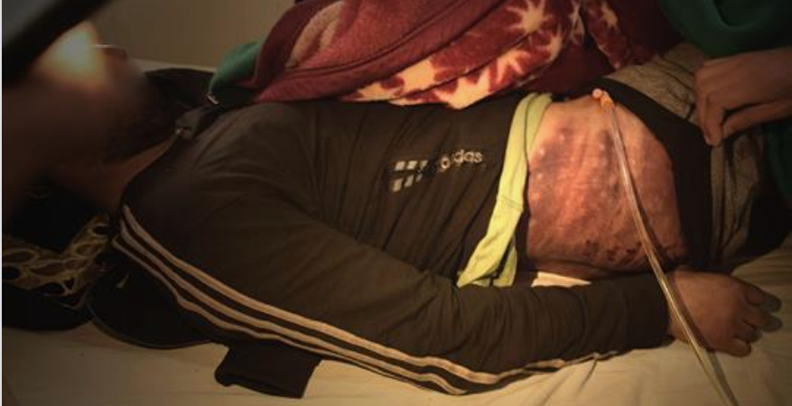 ನಾಪತ್ತೆಯಾದ ಕಾಶ್ಮೀರಿ ಸೈನಿಕನ ಸಹೋದರನಿಗೆ ಸೇನಾ ಶಿಬಿರದಲ್ಲಿ ಗಂಭೀರ ಹಲ್ಲೆ, ಚಿತ್ರಹಿಂಸೆ