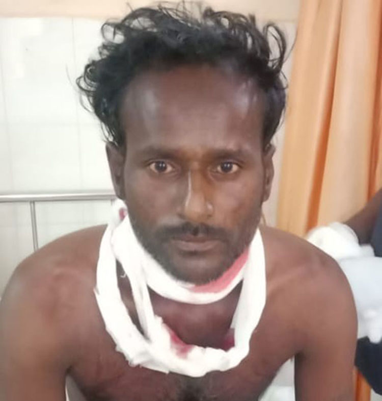 ಕುಂದಾಪುರ: ಕತ್ತಿಯಿಂದ ತನ್ನ ಕತ್ತು, ಮರ್ಮಾಂಗ ಕೊಯ್ದುಕೊಂಡ ಕಾರ್ಮಿಕ !