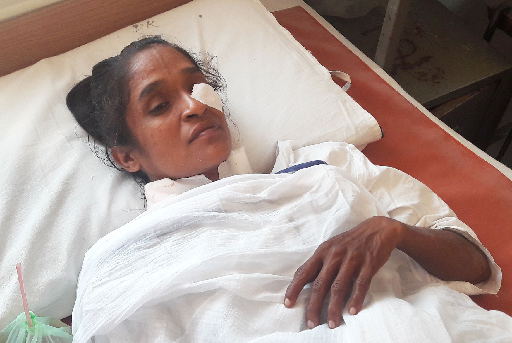 ಕುಂದಾಪುರ ಜಪ್ತಿ ಸಮೀಪ ಚಿರತೆ ದಾಳಿ: ಮಹಿಳೆಗೆ ತೀವ್ರ ಗಾಯ