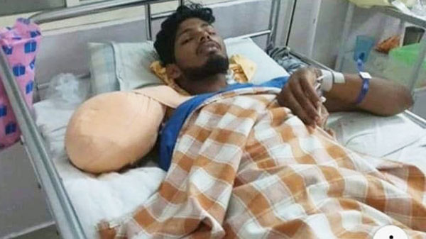 ಅಪಘಾತದಲ್ಲಿ ಬಲಗೈ ಕಳೆದುಕೊಂಡ ಪದವಿ ವಿದ್ಯಾರ್ಥಿ: ಶಸ್ತ್ರಚಿಕಿತ್ಸೆಗಾಗಿ ಆರ್ಥಿಕ ನೆರವಿಗೆ ಮನವಿ