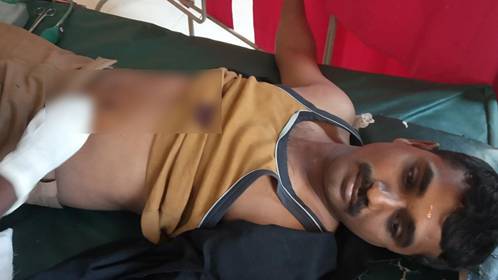 ಬಂದೂಕು ಪರೀಕ್ಷೆಯ ವೇಳೆ ಗುಂಡು ಸಿಡಿದು ಪೊಲೀಸ್ ಮುಖ್ಯಪೇದೆಗೆ ಗಾಯ