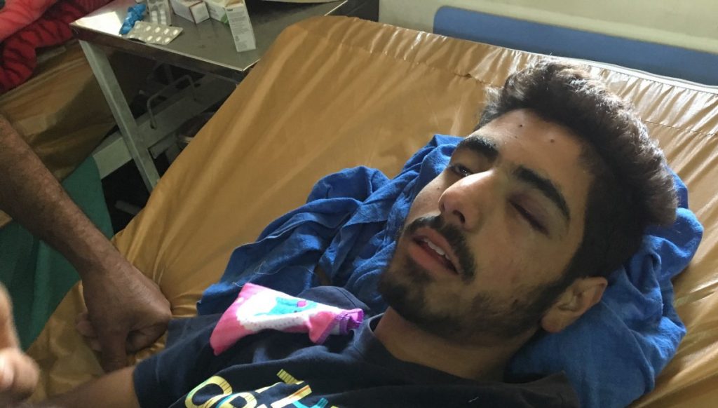 370ನೆ ವಿಧಿ ರದ್ದತಿ ಬಳಿಕ ಬಾಲಕರು ಸೇರಿ 21 ಜನರ ಮೇಲೆ ಪೆಲೆಟ್ ಗುಂಡಿನ ದಾಳಿ