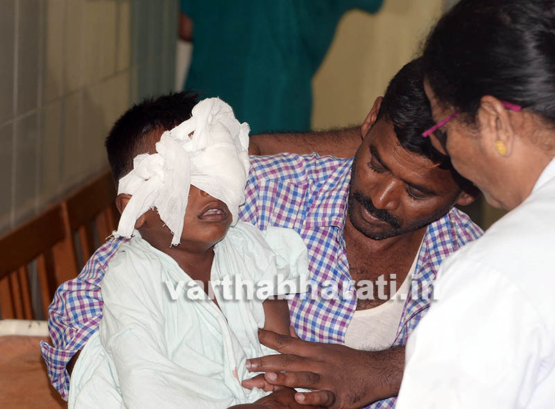 ಬೆಂಗಳೂರಿನ ವಿವಿಧೆಡೆ ಪಟಾಕಿ ಅನಾಹುತ: ಮಕ್ಕಳು ಸೇರಿ 39ಕ್ಕೂ ಅಧಿಕ ಮಂದಿಗೆ ಗಾಯ