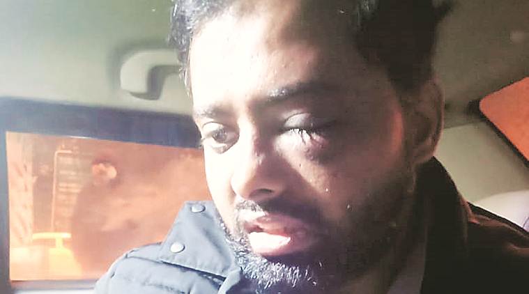 ನನ್ನ ಎಡಗಣ್ಣಿಗೆ ಲಾಠಿ ಏಟು ಬಿದ್ದು ರಕ್ತ ಹರಿಯಿತು: ದೃಷ್ಟಿ ಕಳೆದುಕೊಂಡ ಜಾಮಿಯಾ ವಿದ್ಯಾರ್ಥಿ