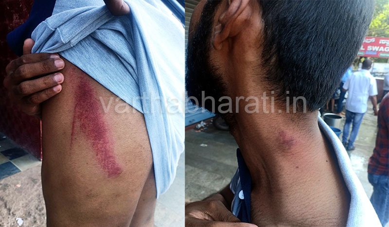 ವರದಿ ಮಾಡುತ್ತಿದ್ದ ಪತ್ರಕರ್ತನ ಕಾಲರ್ ಹಿಡಿದು, ಲಾಠಿ ಬೀಸಿದ ಪೊಲೀಸರು