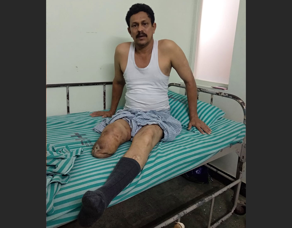 ವಿಕಲಚೇತನ ವ್ಯಕ್ತಿಗೆ ಹಿಗ್ಗಾಮುಗ್ಗಾ ಥಳಿಸಿದ ಪೊಲೀಸರು: ಆರೋಪ