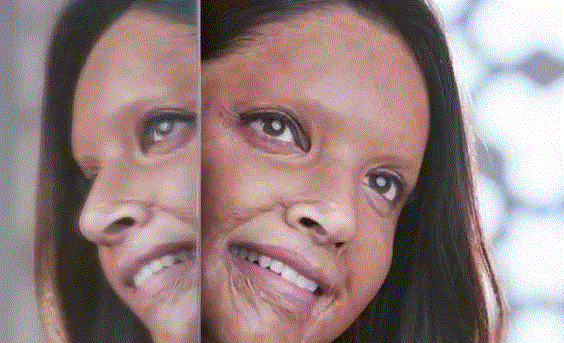 ಅವರು ರೇಟಿಂಗ್ ಬದಲಿಸಿರಬಹುದು, ನನ್ನ ಮನಸ್ಸನ್ನಲ್ಲ: ಚಪಾಕ್ ವಿರುದ್ಧದ ಅಪಪ್ರಚಾರದ ಬಗ್ಗೆ ದೀಪಿಕಾ