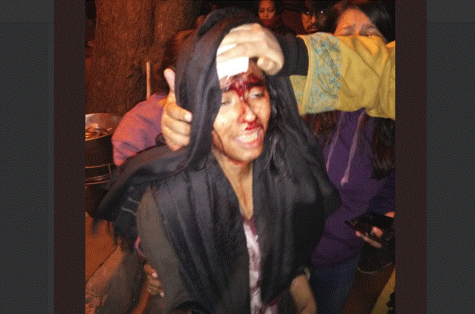 ಆಸ್ಪತ್ರೆಗೆ ಸಾಗಿಸುತ್ತಿದ್ದಾಗಲೇ ಐಶ್ ಘೋಷ್ ಮೇಲೆ 4 ನಿಮಿಷಗಳಲ್ಲಿ 2 ಪ್ರಕರಣ ದಾಖಲಿಸಿದ್ದ ಪೊಲೀಸರು!