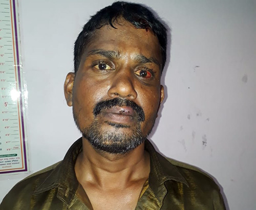 ಕಳವು ಪ್ರಕರಣ : ಆರೋಪಿ ಸೆರೆ