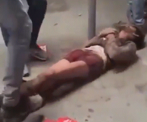 ಕಳ್ಳತನ ಆರೋಪದಲ್ಲಿ ದಲಿತ ಯುವಕರ ಬಟ್ಟೆ ಬಿಚ್ಚಿ ಹಲ್ಲೆ: ಖಾಸಗಿ ಭಾಗಕ್ಕೆ ಸ್ಕ್ರೂ ಡ್ರೈವರ್ ನಿಂದ ತಿವಿದ ದುಷ್ಕರ್ಮಿಗಳು