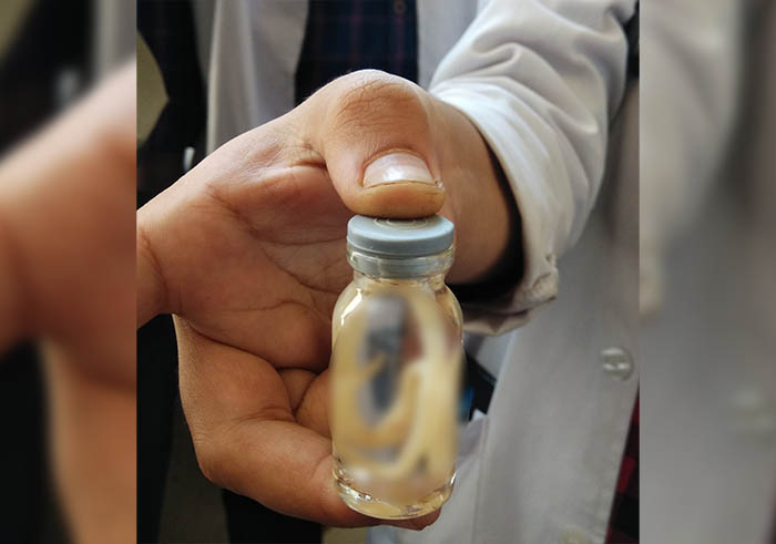 ಮಗುವಿನ ಹೊಟ್ಟೆಯಲ್ಲಿದ್ದ ದೊಡ್ಡ ಗಾತ್ರದ ಹುಳು ಹೊರ ತೆಗೆದ ವೈದ್ಯರು