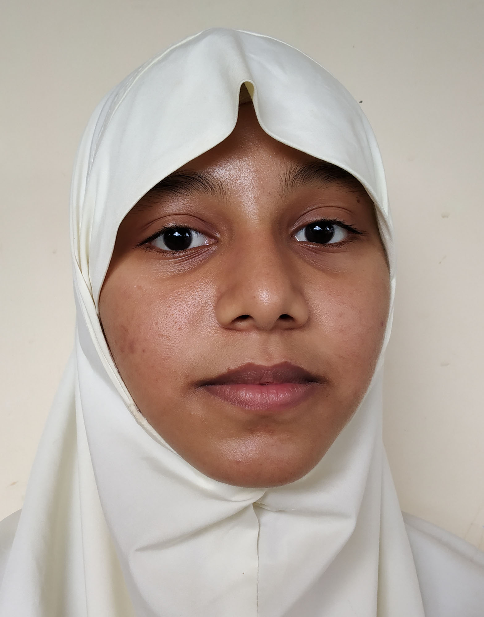 ರಾಜ್ಯುಟ್ಟದ ಪ್ರತಿಭಾ ಕಾರಂಜಿಯಲ್ಲಿ ದ್ವಿತೀಯ