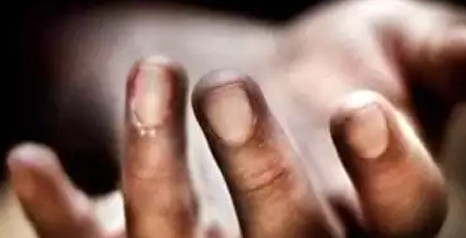 ಮಲೇರಿಯಾ ನಿರೋಧಕ ಔಷಧ ಸೇವಿಸಿ ವೈದ್ಯ ಮೃತ್ಯು