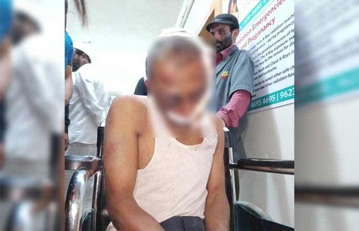 ಎಮ್ಮೆಮಾಡು ಜಮಾಅತ್ ಮಂಡಳಿ ಸದಸ್ಯನ ಮೇಲೆ ಮಾರಣಾಂತಿಕ ಹಲ್ಲೆ