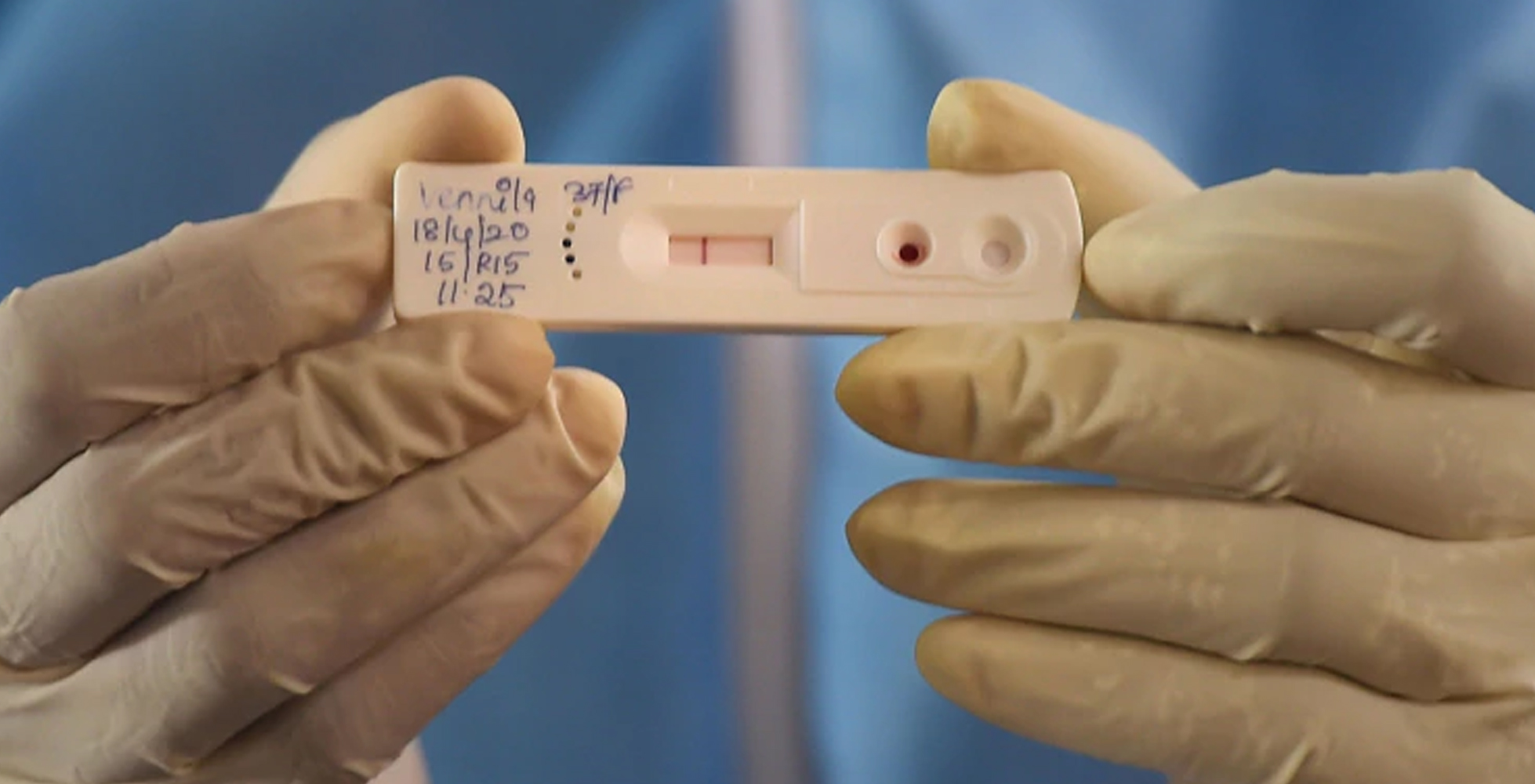 ಪಶ್ಚಿಮ ಬಂಗಾಳ: ದೋಷಯುಕ್ತ ಕಿಟ್‌ಗಳನ್ನು ಬದಲಿಸಿದ ಐಸಿಎಂಆರ್