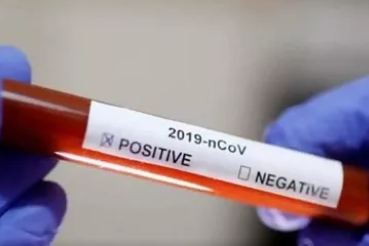 ಕೊರೋನ ವೈರಸ್: ಜಾಗತಿಕ ಮೃತರ ಸಂಖ್ಯೆ 76,500