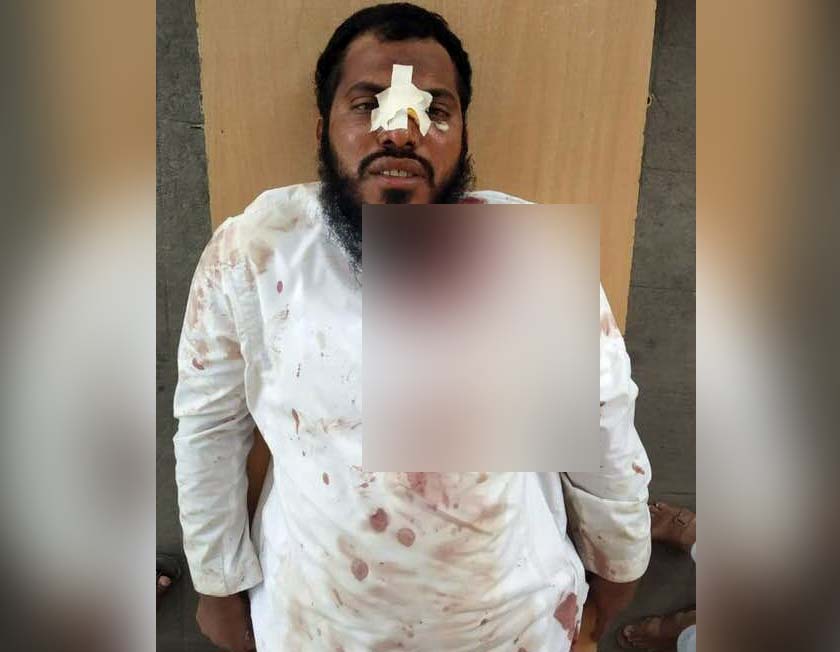 ಬೀದರ್: ತರಕಾರಿ ಖರೀದಿಸಿ ಹಿಂದಿರುಗುತ್ತಿದ್ದ ಧರ್ಮಗುರುವಿಗೆ ಮಾರಣಾಂತಿಕ ಹಲ್ಲೆ; ಪೊಲೀಸ್ ಅಧಿಕಾರಿ ಅಮಾನತು