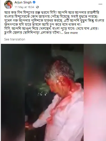 ಫ್ಯಾಕ್ಟ್ ಚೆಕ್: ಬಿಜೆಪಿ ಸಂಸದ ಶೇರ್ ಮಾಡಿದ್ದ ವಿಡಿಯೋದಲ್ಲಿರುವ ಕೋಮು ಗಲಭೆಯ ಗಾಯಾಳು ಹಿಂದೂ ಅಲ್ಲ, ಮುಸ್ಲಿಂ