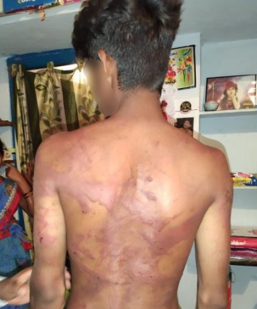 ದಲಿತ ಯುವಕನಿಗೆ ಥಳಿಸಿ ಮೂತ್ರ ಕುಡಿಸಿದ ದುಷ್ಕರ್ಮಿಗಳು: ಆರೋಪ