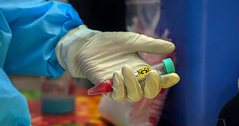 ಕಾಸರಗೋಡು : ಇಂದು 10 ಮಂದಿಗೆ ಕೊರೋನ ಪಾಸಿಟಿವ್