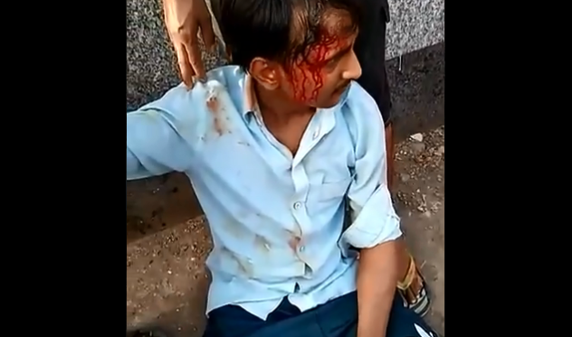 ದುಪ್ಪಟ್ಟು ಹಣ ಪಡೆದು ವಂಚನೆ: ಪ್ರಶ್ನಿಸಿದ ವಲಸೆ ಕಾರ್ಮಿಕರಿಗೆ ಮಾರಣಾಂತಿಕ ಹಲ್ಲೆಗೈದ ಬಿಜೆಪಿ ಕಾರ್ಯಕರ್ತ; ಆರೋಪ