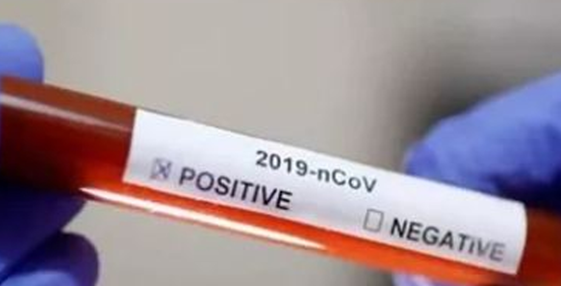 ದ.ಕೊರಿಯದಲ್ಲೂ ಕಡಿವಾಣವಿಲ್ಲದ ಕೊರೋನ: ಹೊಸ ಸೋಂಕಿನ ಪ್ರಕರಣಗಳಲ್ಲಿ ಭಾರೀ ಏರಿಕೆ