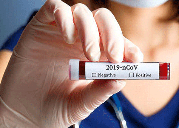 ಪ್ರಯೋಗಾಲಯದ ವರದಿಯಲ್ಲಿ ಕೋವಿಡ್ ನೆಗೆಟಿವ್, ಆರೋಗ್ಯ ಇಲಾಖೆಯ ವರದಿಯಲ್ಲಿ ಪಾಸಿಟಿವ್ !