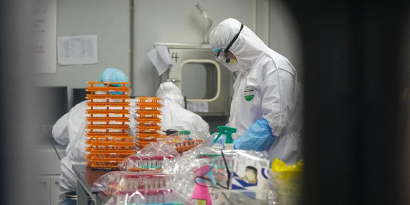 ಉಡುಪಿ ಜಿಲ್ಲೆಯಲ್ಲಿ ರವಿವಾರ 169 ಮಂದಿಗೆ ಕೊರೋನ ಪಾಸಿಟಿವ್