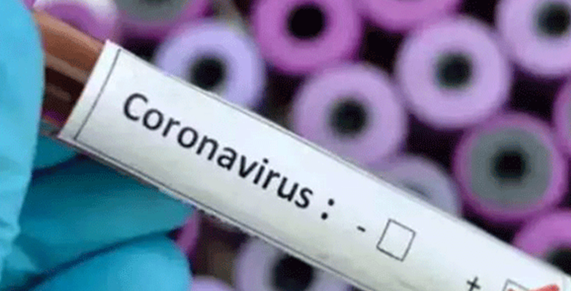 ಗುಜರಾತ್: ವಡೋದರಾ ಕಾರಾಗೃಹದ 60 ಕೈದಿಗಳಿಗೆ ಕೊರೋನ ಸೋಂಕು