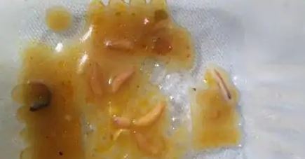 ಉತ್ತರ ಪ್ರದೇಶ: ಕೊರೋನ ವಿರುದ್ಧ ಹೋರಾಟ ನಡೆಸುತ್ತಿರುವ ವೈದ್ಯರಿಗೆ ನೀಡುವ ಆಹಾರದಲ್ಲಿ ಹುಳಗಳು!