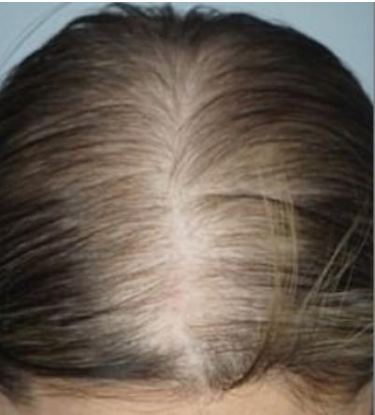 ಈ ಪುಟ್ಟ ಕೆಂಪು ಬೀಜಗಳು ಕೂದಲ ಬೆಳವಣಿಗೆ ಮತ್ತು ನಿರೋಧಕ ಶಕ್ತಿಯನ್ನು ಹೆಚ್ಚಿಸುತ್ತವೆ