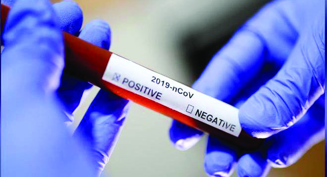 28 ದಿನಗಳ ಕಾಲ ಬದುಕಬಲ್ಲದು ಕೊರೋನ ವೈರಸ್: ಆಸ್ಟ್ರೇಲಿಯ ವಿಜ್ಞಾನಿಗಳ ಸಂಶೋಧನೆ