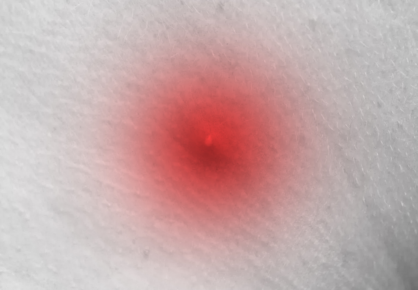 ಮೊಡವೆಗಳು ನಿಮ್ಮ ಆರೋಗ್ಯದ ಬಗ್ಗೆಯೂ ಹೇಳುತ್ತವೆ