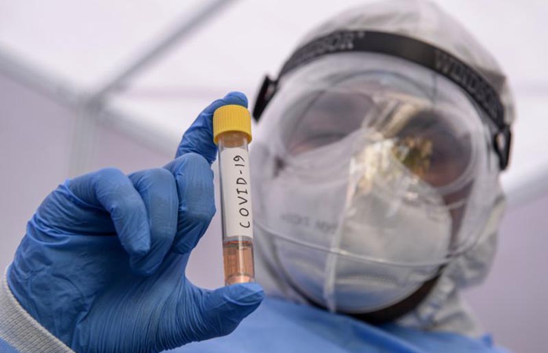 ರಾಜ್ಯದಲ್ಲಿ ಹೊಸದಾಗಿ 8,477 ಕೊರೋನ ಪ್ರಕರಣಗಳು ದೃಢ: 85 ಸೋಂಕಿತರು ಸಾವು