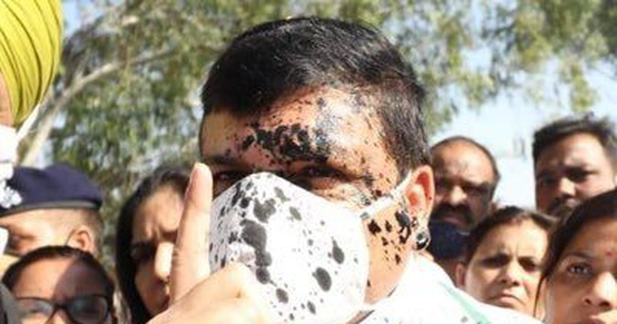 ಆದಿತ್ಯನಾಥ್ ಓರ್ವ ಹೇಡಿ: ಶಾಯಿ ಎರಚಿದ ಘಟನೆಯ ಬಳಿಕ ಸಂಜಯ್ ಸಿಂಗ್ ಆಕ್ರೋಶ