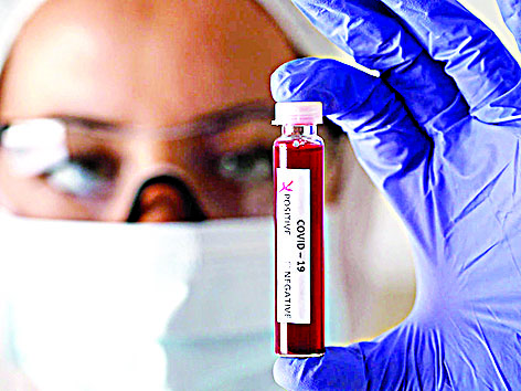 ಜಗತ್ತಿನ 10ರಲ್ಲಿ ಒಬ್ಬ ವ್ಯಕ್ತಿ ಕೊರೋನ ಸೋಂಕು ಪೀಡಿತ: ವಿಶ್ವ ಆರೋಗ್ಯ ಸಂಸ್ಥೆ