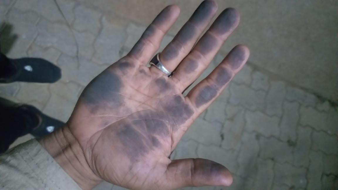 ಜೋಕಟ್ಟೆಯಲ್ಲಿ ಮತ್ತೆ ಕೋಕ್ ಹುಡಿಕಾಟ : ಸ್ಥಳೀಯರಲ್ಲಿ ಹೆಚ್ಚಿದ ಆತಂಕ