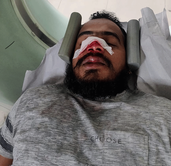 ಶಿವಮೊಗ್ಗ: ಬಜರಂಗದಳದ ಕಾರ್ಯಕರ್ತನ ಮೇಲೆ ಹಲ್ಲೆ