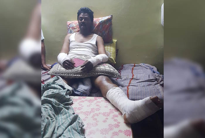 ಜಾನುವಾರು ಸಾಗಿಸುತ್ತಿದ್ದಾಗ ದುಷ್ಕರ್ಮಿಗಳಿಂದ ಹಲ್ಲೆ ಪ್ರಕರಣ: ಕೈ, ಕಾಲಿನ ಮೂಳೆ ಮುರಿದು ಶೋಚನೀಯ ಸ್ಥಿತಿಯಲ್ಲಿ ಚಾಲಕ