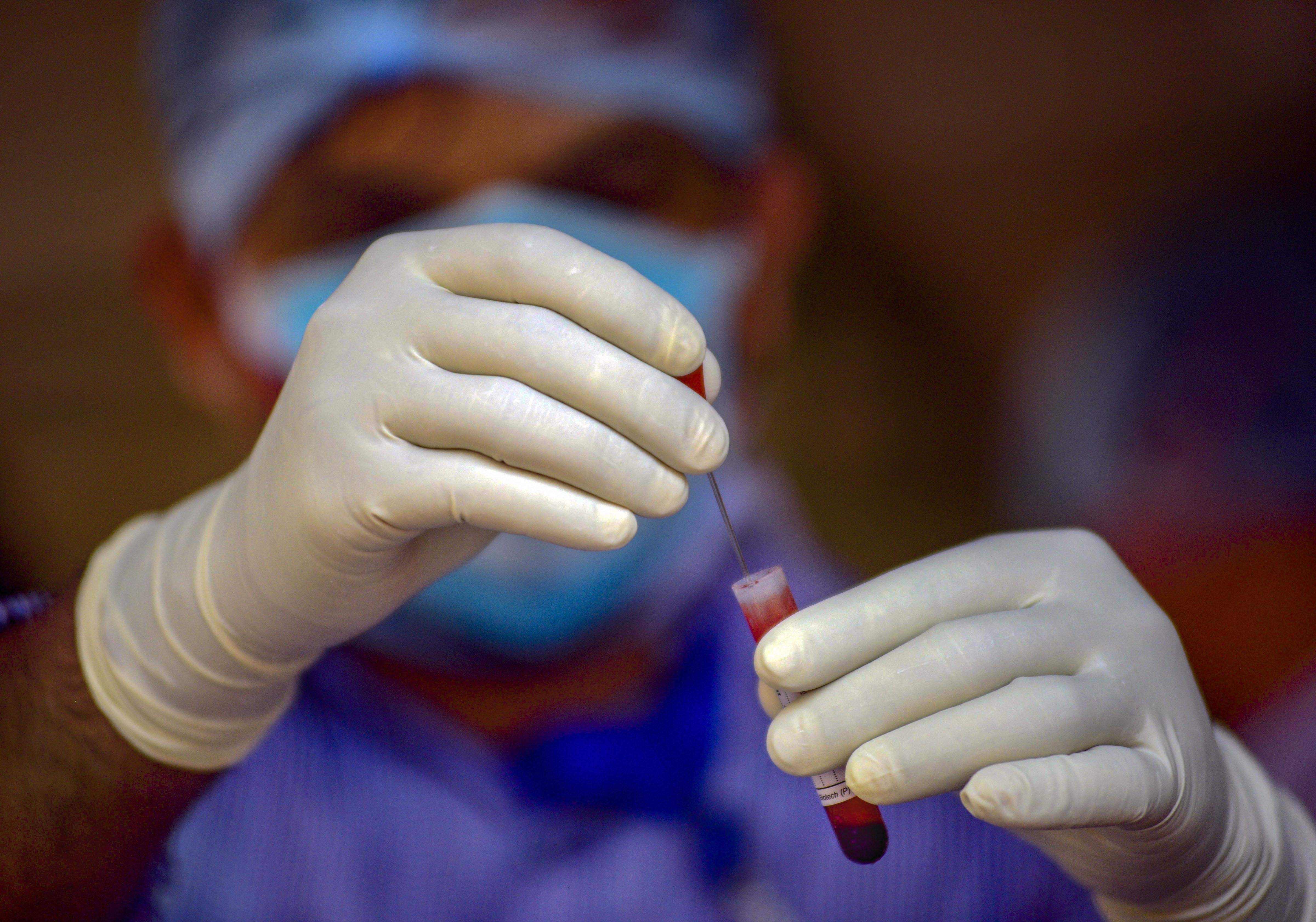 ಉಡುಪಿ: 19 ಮಂದಿಯಲ್ಲಿ ಕೋವಿಡ್ ಸೋಂಕು ಪತ್ತೆ