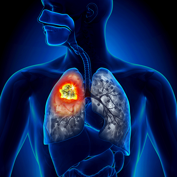 ಕ್ಯಾನ್ಸರ್  ಗೆಲ್ಲಲು ಸಾಧ್ಯವಿದೆ