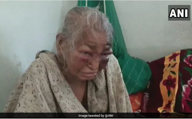 ಬಿಜೆಪಿ ಕಾರ್ಯಕರ್ತನ ತಾಯಿಗೆ ಟಿಎಂಸಿಗರಿಂದ ಹಲ್ಲೆ ಪ್ರಕರಣ: ಮಗನೇ ಅಮ್ಮನಿಗೆ ಥಳಿಸುತ್ತಿದ್ದ ಎಂದ ಸಂಬಂಧಿ!