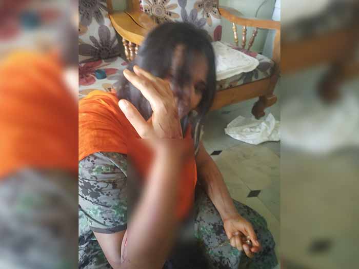 ಸಿಎಂ ಬಿಎಸ್‌ವೈ ಪುತ್ರನ ಕಾರು ತಡೆದು ನ್ಯಾಯಕ್ಕೆ ಅಂಗಲಾಚಿದ್ದ ಮಹಿಳೆಗೆ ದುಷ್ಕರ್ಮಿಗಳಿಂದ ಹಲ್ಲೆ