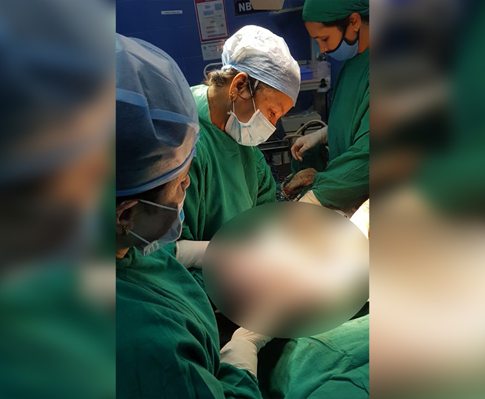 ಯುವತಿಯ ಹೊಟ್ಟೆಯಲ್ಲಿದ್ದ 8 ಕೆ.ಜಿ ಗೆಡ್ಡೆ ಹೊರತೆಗೆದ ಸಾಗರದ ಸರ್ಕಾರಿ ಆಸ್ಪತ್ರೆ ವೈದ್ಯರು