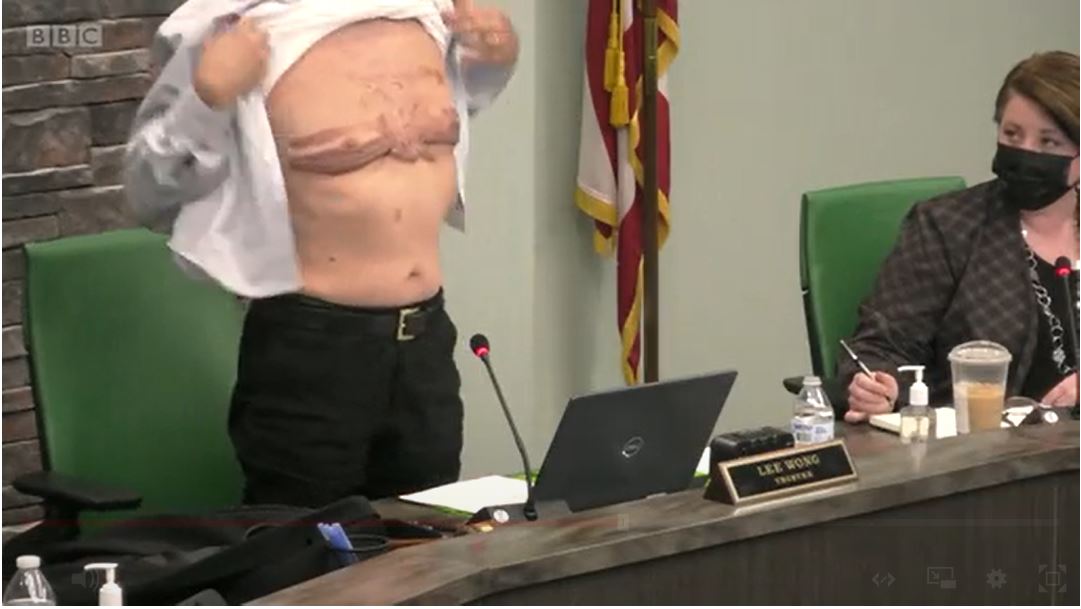 ತನ್ನ ದೇಶಭಕ್ತಿಯನ್ನು ಪ್ರಶ್ನಿಸಿದ್ದಕ್ಕೆ ಸಭೆಯ ಮಧ್ಯೆಯೇ ಶರ್ಟ್‌ ತೆಗೆದು ಗಾಯದ ಕಲೆಗಳನ್ನು ಪ್ರದರ್ಶಿಸಿದ ಸೈನಿಕ