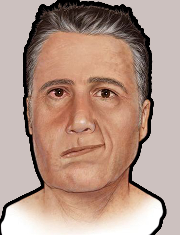 ಬೆಲ್ಸ್ ಪಾಲ್ಸಿ:ಕಾರಣಗಳು ಮತ್ತು ಲಕ್ಷಣಗಳು, ಏನಿದು ಬೆಲ್ಸ್ ಪಾಲ್ಸಿ?