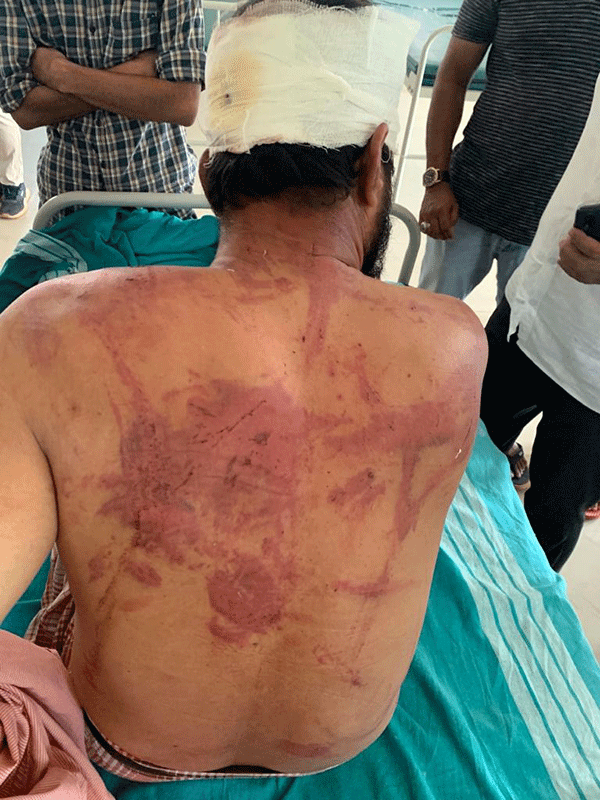 ಬೆಳ್ತಂಗಡಿ: ದನ ಸಾಗಾಟದ ಆರೋಪದಲ್ಲಿ ಇಬ್ಬರಿಗೆ ಸಂಘ ಪರಿವಾರ ಕಾರ್ಯಕರ್ತರಿಂದ ಮಾರಣಾಂತಿಕ ಹಲ್ಲೆ