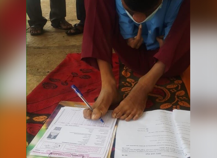 ಕಲಬುರಗಿ: ಕಾಲು ಬೆರಳಿನಿಂದಲೇ ಎಸೆಸೆಲ್ಸಿ ಪರೀಕ್ಷೆ ಬರೆದ ವಿದ್ಯಾರ್ಥಿ