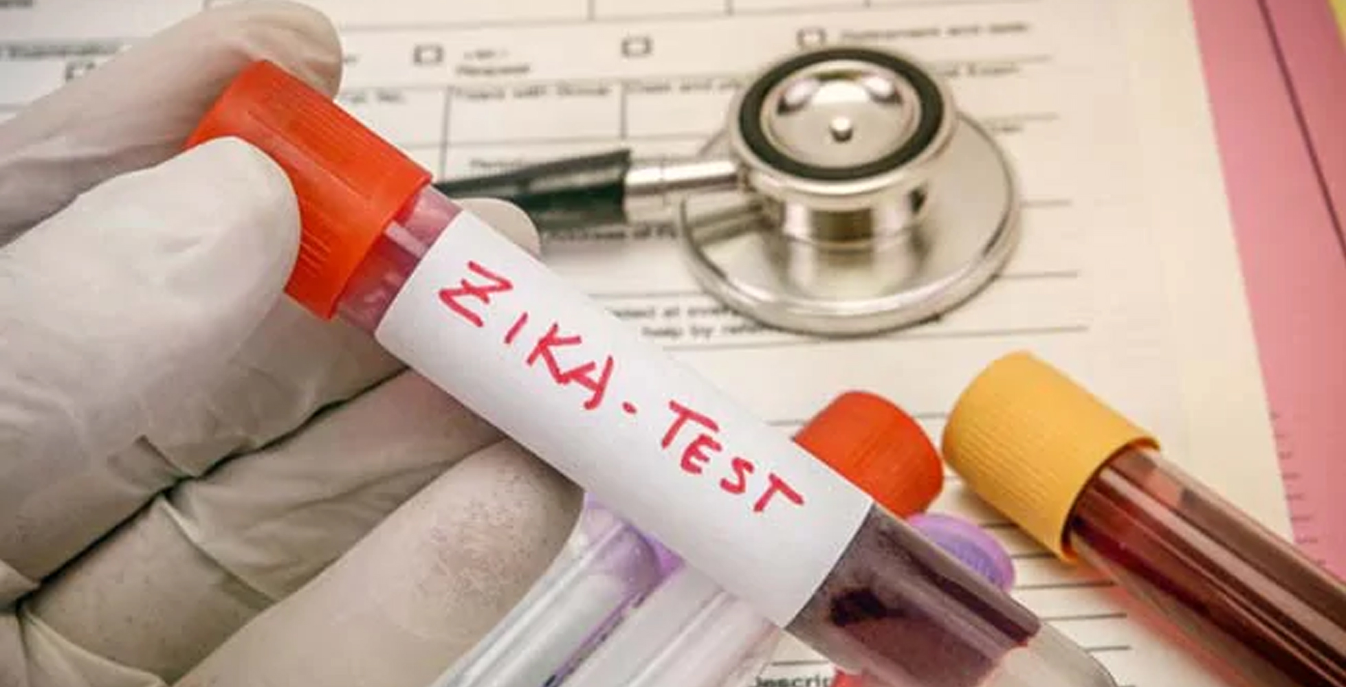 ಕೇರಳ: ಮತ್ತೆ ಝಿಕಾ ವೈರಸ್ ನ 14 ಪ್ರಕರಣಗಳು ಪತ್ತೆ