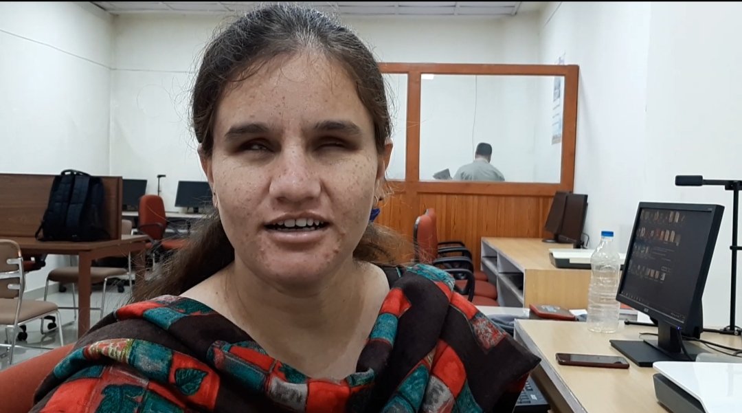 ಅಂಧ ಪಿಎಚ್ಡಿ ವಿದ್ಯಾರ್ಥಿನಿ ಮುಸ್ಕಾನ್ ಗೆ ಚು.ಆಯೋಗದ ‘ಯುವ ಐಕಾನ್’ ಕಿರೀಟ